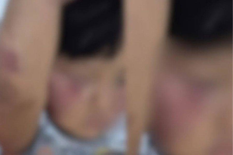 Na imagem em destaque, a criança vítima de violência