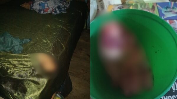 Homem é preso em flagrante após decepar mão da companheira em Igarapé-Miri